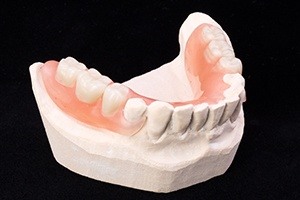 Dentist in Weatherford holding dentures